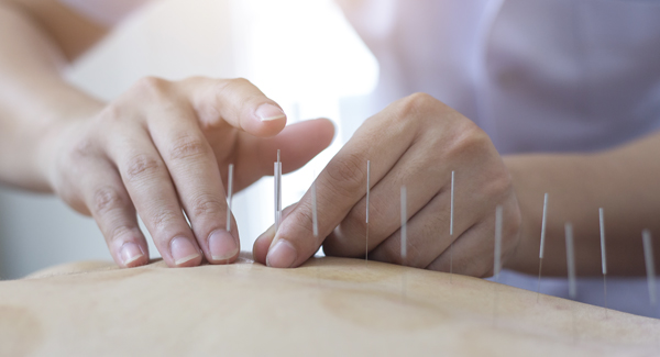 Acupuncture for JA: What You Should Know